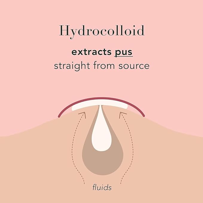 a.l.m. Magical Patch: Hydrocolloid pimple patches. These ultra thin & translucent hydrocolloid adhesive covers and absorb unwanted pimples. Parches Para Acne for skincare.