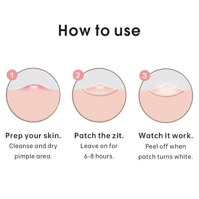 Hydrocolloid Acne Pimple Patches – Invisible Zit Stickers for Face & Skin | Blemish Spot Dots with Tea Tree Oil, Overnight Pimple Patch for Teens & Breakouts