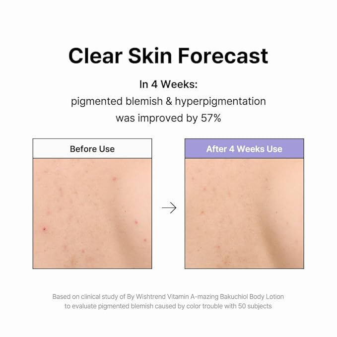 BY WISHTREND Vitamin A-mazing Bakuchiol Body Lotion 150g, Korean body lotion, skin bumps, chicken skin, hyperpigmentation, dull wrinkles, pore care for All Skin Types