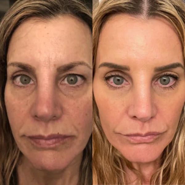 Gin Amber Beauty - Retinol 2.5% Serum - Anti-aging | Brighthening, Plant Based Retinol Serum (1 fl oz - 30 ml)