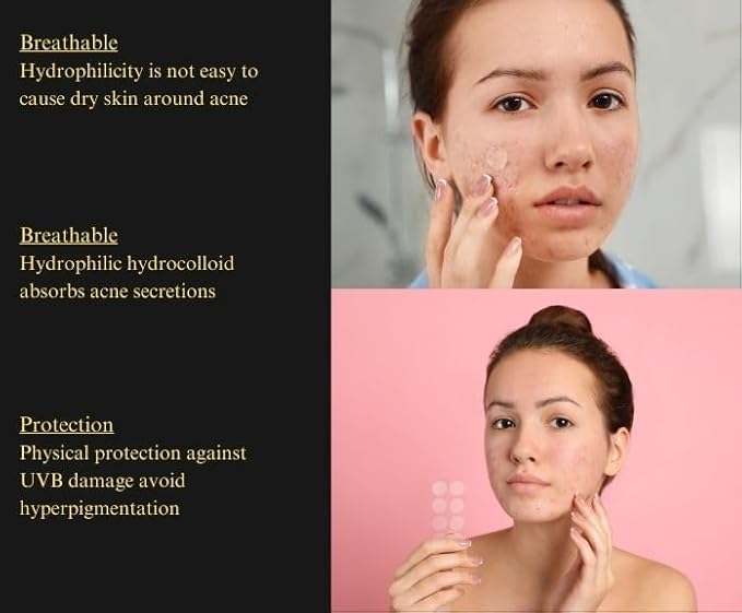 Pimple Patches – Hydrocolloid with Salicylic Acid, Tea Tree Oil & Niacinamide – Invisible, Waterproof for Blemish-Prone Skin – 36 Count