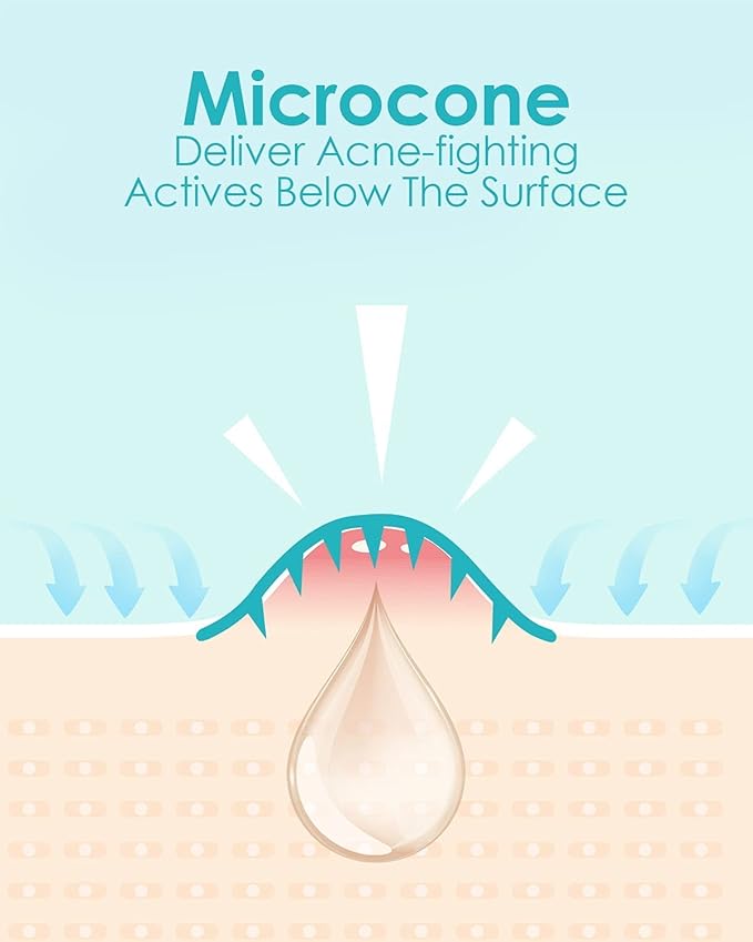 Microdart Acne Patch (54 Patches) - Hyaluronate Acid & Salicylic Acid Hydrocolloid Pimple Patch for Deep, Early and Hidden Blemishes (54 Count (Pack of 1))