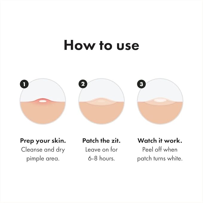 a.l.m. Magical Patch (2) Hydrocolloid pimple patches. These ultra thin & translucent hydrocolloid adhesive covers and absorb unwanted pimples. Parches Para Acne for skincare.