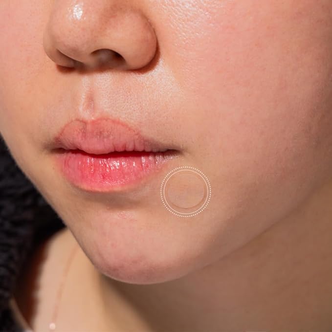 PATCH PRO Easy Roll Spot Patch - Korean Pimple Dispenser, Invisible Hydrocolloid Redness Patches, Shrinks Pimples, Invisible Covers skincare for Blemishes, Skincares Stickers (140 Count Pack of 2)