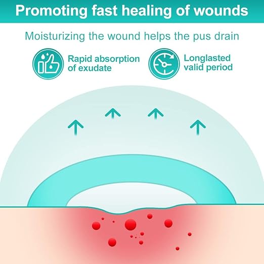 Dimora Hydrocolloid Dressing 4" x 4" for Wound Care, 10 Pack Large Patch Bandages with Self-Adhesive for Bedsore, Burn, Blister, Acne Care, Super Absorbent for Fast Healing