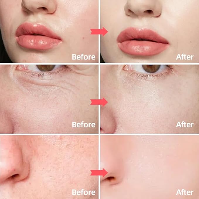 Retinol & Collagen Face Cream ā Anti-Aging Moisturizer for Wrinkles & Fine Lines | Hyaluronic Acid & Peptides | Hydrates & Restores Skin Elasticity