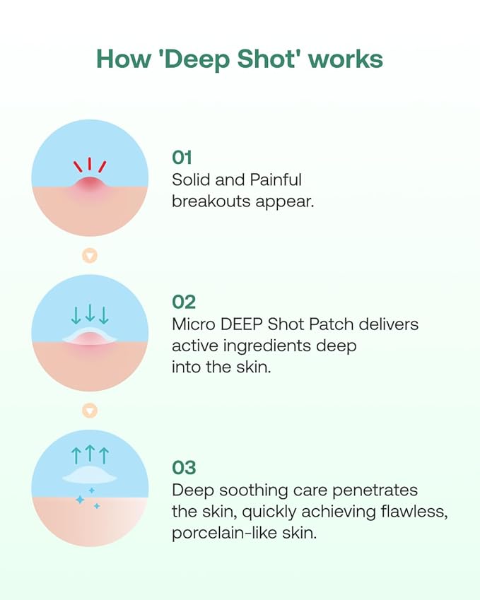 Yangyang Pine Quick Calming Spot Patch 12 Patches, Hyaluronic Acid Soothing Deep Shot, Blemish Relief, Pimples Care, Ultra-Thin Hydrocolloid Patch, Non-Irritating Acne Treatment