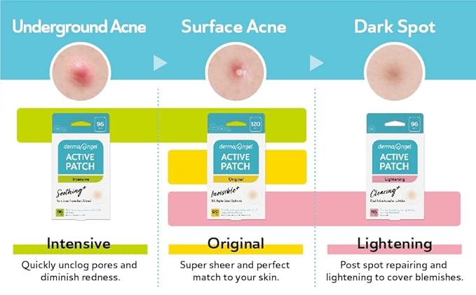 Dark Spot Patches Blemish Patches with Hydrocolloid, TXA & CICA for Active Acne & Post-Inflammatory Dark Spots - Day and Night Use - UPGRADED (Post Acne - 96 Count - 1 Size)