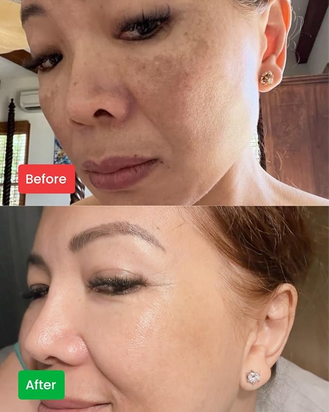 Brightening Facial Serum has Vitamin C, Niacinamide, Retinoate, Vitamine E, and Natural Ingredients help Reduce Dark Spots & Hyperpimentation, Smooth & Evens Skin Tone, Reduces Fine Lines.