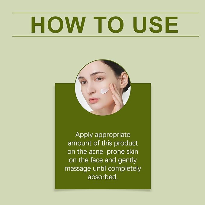 Acne Cream for Face – 15g Oil Balancing Pimple, Helps Reduce Breakouts for Oily & Blemish-Prone Skin, Gentle Daily Moisturizer for Teens & Adults (Unisex, Cruelty-Free)