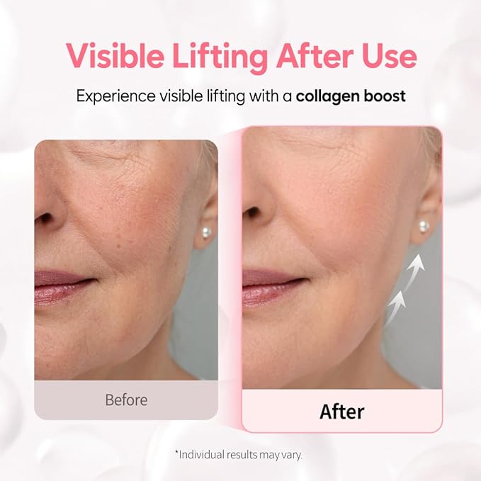 Overnight Collagen Lifting Gel Mask 5 pcs, Korean Face Lifting Deep Hydrogel Mask for Glass Skin, Anti-Aging with PDRN (Salmon DNA), Hyaluronic Acid for Elasticity, Firmness