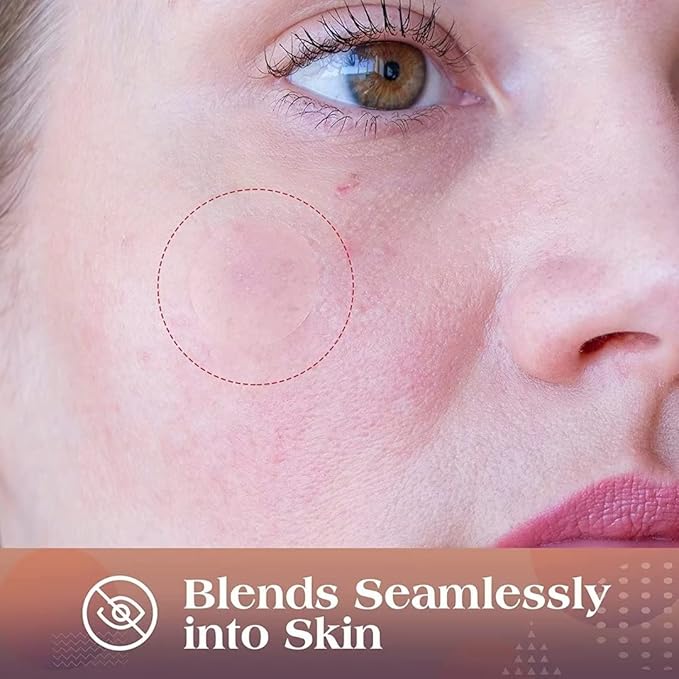 AUSLKA Blemishes Patches -175 Patches - Hydrocolloid Spot Dots - Blemishes Patch - Pimple Stickers, For Face Absorbing Cover Patch
