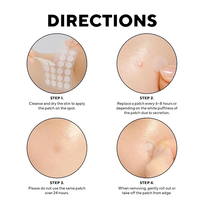 caraseoul Pimple Patches, 2 Size Hydrocolloid Acne Patch for Zits and Blemishes, Bakuchiol & Aloe Vera, Korean Skin Care, Easy to Use – Dermatology Tested