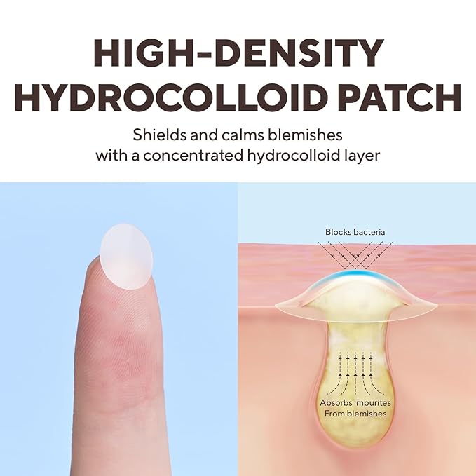 caraseoul Overnight Pimple Patches, Thicker & Extra Adhesion, 2 Size Hydrocolloid Acne Patch for Zits and Blemishes, Bakuchiol & Aloe Vera, Korean Skin Care, Easy to Use – Dermatology Tested