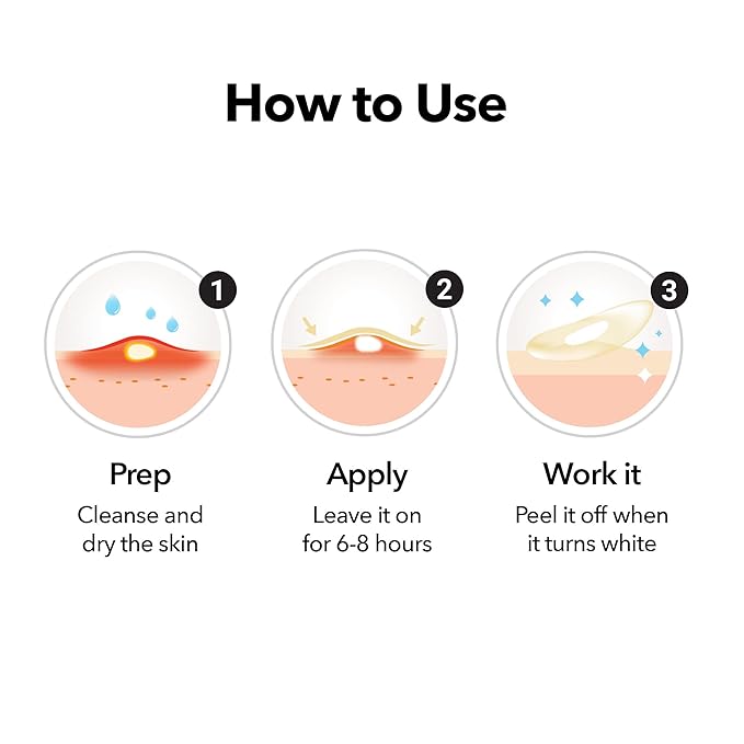 FreeGo Hydrocolloid Acne Patches for Face, Large Pimple Patches for Breakouts, Zit, Blemish Spot, Facial Stickers, Korean Pimple Patches