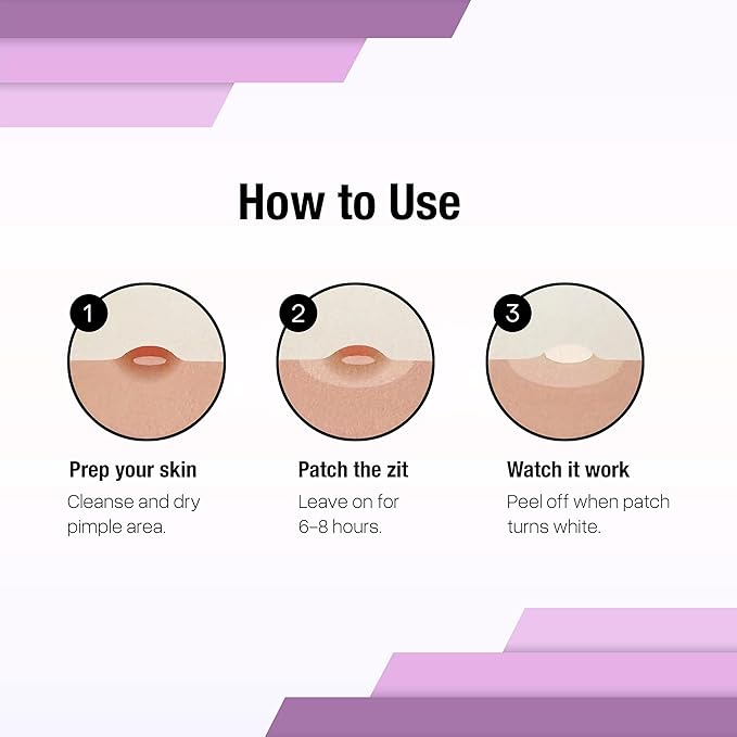 Hydrocolloid Acne Pimple Patches for Covering Zits and Blemishes, Spot Stickers for Face and Skin (72 Count)