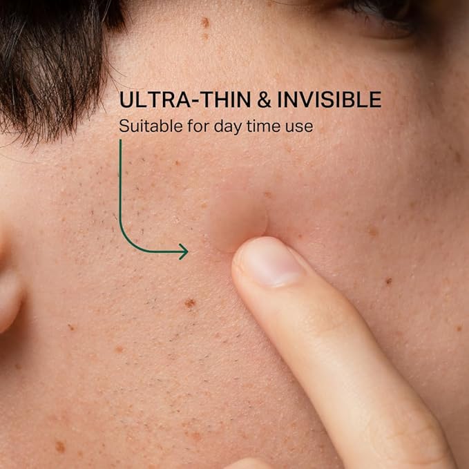 Y’OUR Improving Acne Patches: Hydrocolloid Pimple Patch for Face; Purifies & Alleviates Stubborn Blemishes, Promotes Healing, Effective Zit Treatment. Made in USA. 56 Count