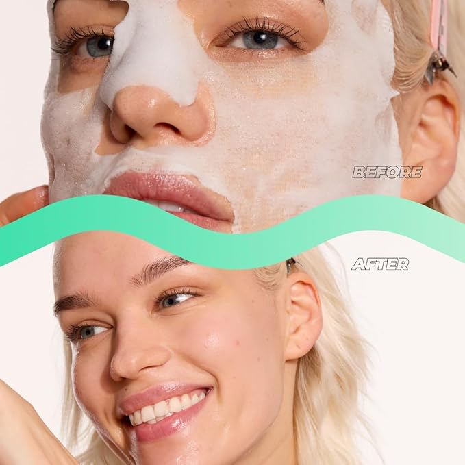 Vitamasques Oxygenating Matcha Green Tea Face Mask, For All Skin Types (Pack of 3)