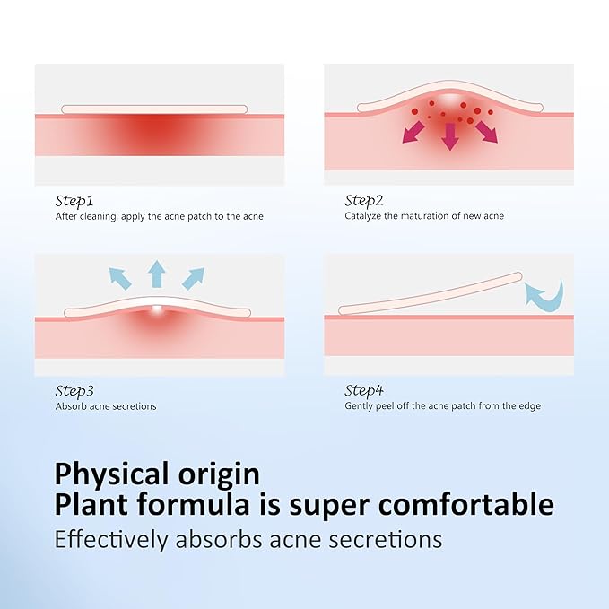 Star Pimple Patches for Face, Acne Patches, Cute Colorful Star Zit Covers with Hydrocolloid & Tea Tree Oil, Salicylic Acid Cica Extract 4 Sizes (8mm/9mm/11mm/14mm) | 357 Count