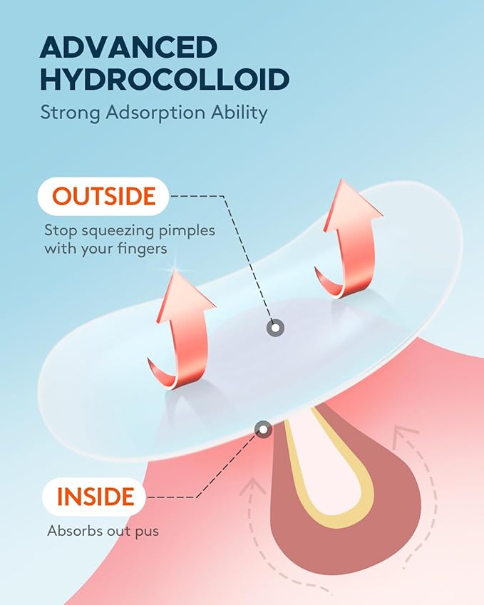 Acne Pimple Patch (180 Counts 4 Sizes), FSA Eligible Invisible Hydrocolloid Acne Patch with Tea Tree Oil & Calendula Oil, Acne Spot Patch Zit Patches for Face