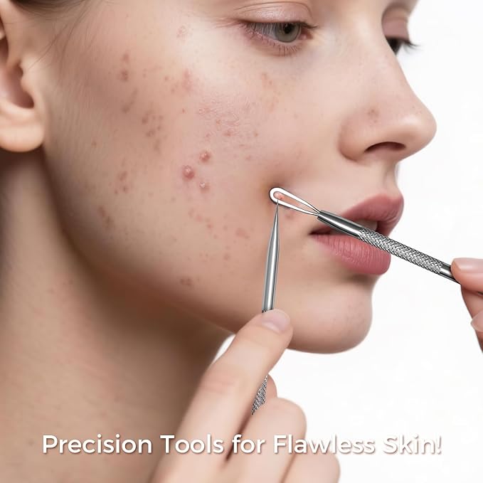 Blackhead Remover Tool Kit, 6 Pcs Pimple Popper Comedone Extractor Set with Acne Needles, Tweezers, Pore Scraper for Blemish, Zit, Whitehead Removal on Nose and Face, with Storage Case