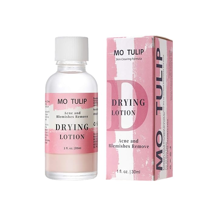 MO TULIP Acne Drying Lotion, Overnight Acne Acid and Acne Spot Treatment for Face and Body, Pimple Lotion Spot Treatment, Dry Out Pimples, Blemishes, and Clean pores (1OZ)