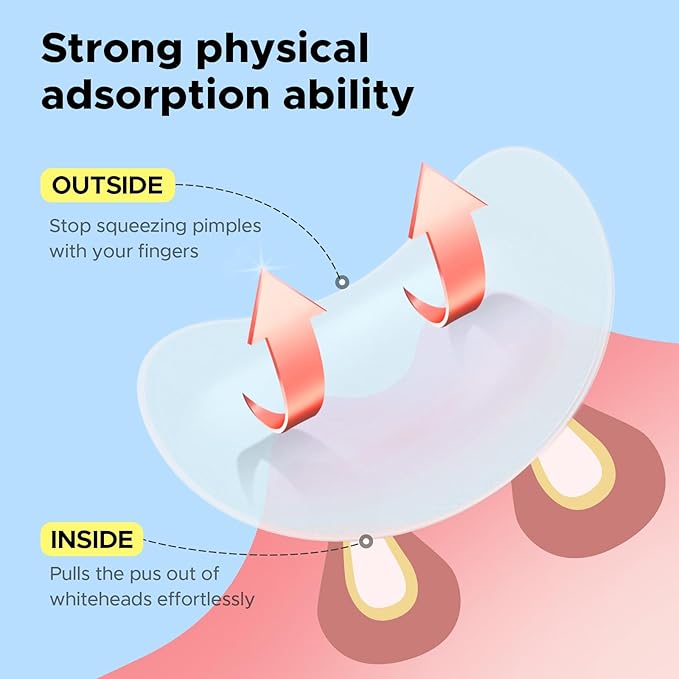 LitBear Pimple Patches for Face, Large Acne Patch, XL Hydrocolloid Bandages,Zit Stickers for Forehead, Chin, Nose, Body, Back, and Chest (5 Sizes, 228 Pimple Patches)