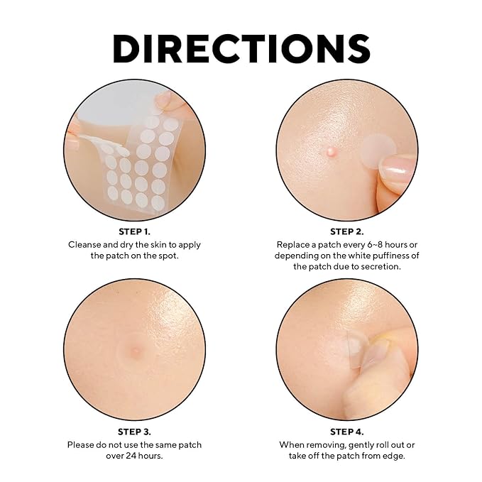 caraseoul Pimple Patches, 2 Size Hydrocolloid Acne Patch for Zits and Blemishes, Bakuchiol & Aloe Vera, Korean Skin Care, Easy to Use – Dermatology Tested