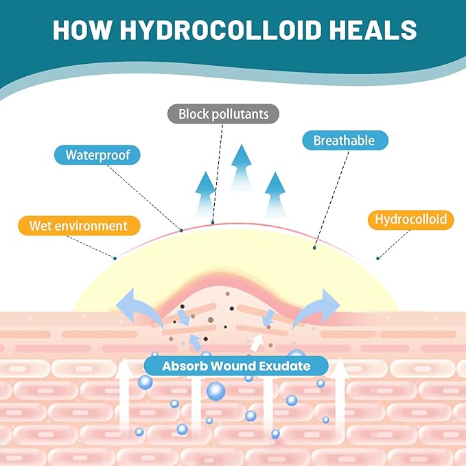 WUYUAN Hydrocolloid Roll for Wound Care, 4in*6.6ft Hydrocolloid Bandages with Self-Adhesive, Extra Large Hydrocolloid Patch Bandages Cut-to-Size, Ultra Absorbent, Waterproof