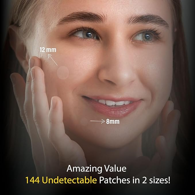 Hydrocolloid Acne Pimple Invisible 144 Patches with Tea Tree Oil & Salicylic Acid I Ultra Thin Absorbing Spot Stickers for Face, Skin I Covers Blemishes, Zits I Different Sizes 8mm, 12mm