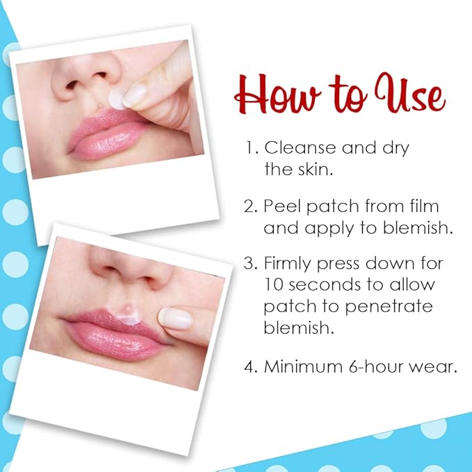 Bye Bye Blemish Acne Patches, 9 Clear Pimple Patches for Fast Acne Treatment, Blemish Spot Treatment for All Skin Types, 1-Pack