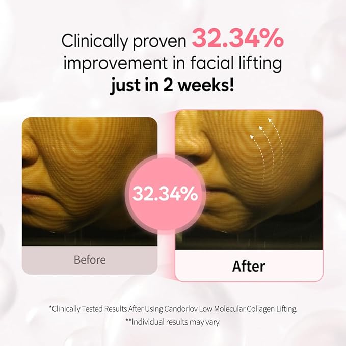 Overnight Collagen Lifting Gel Mask 5 pcs, Korean Face Lifting Deep Hydrogel Mask for Glass Skin, Anti-Aging with PDRN (Salmon DNA), Hyaluronic Acid for Elasticity, Firmness