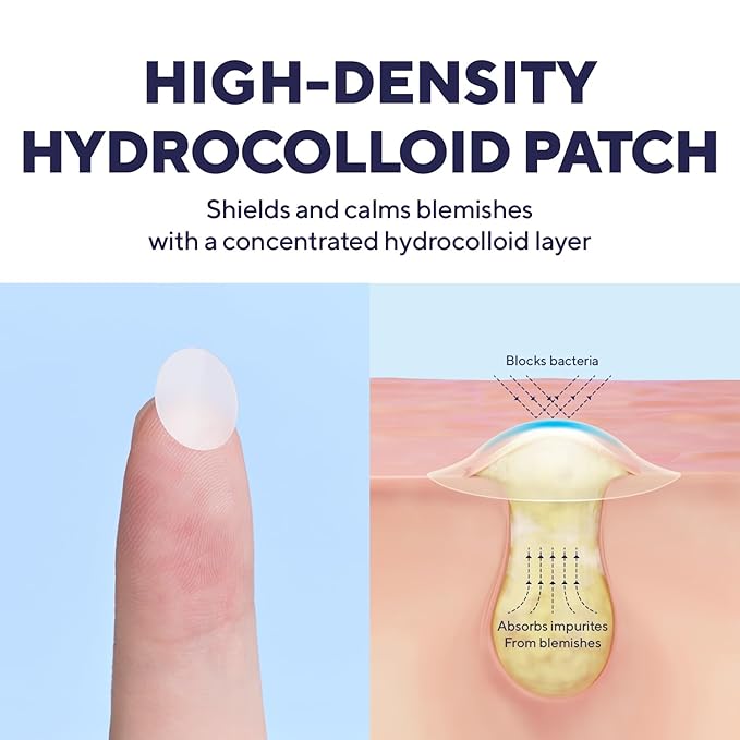 caraseoul Overnight Pimple Patches, Thicker & Extra Adhesion, 2 Size Hydrocolloid Acne Patch for Zits and Blemishes, Bakuchiol & Aloe Vera, Korean Skin Care, Easy to Use – Dermatology Tested