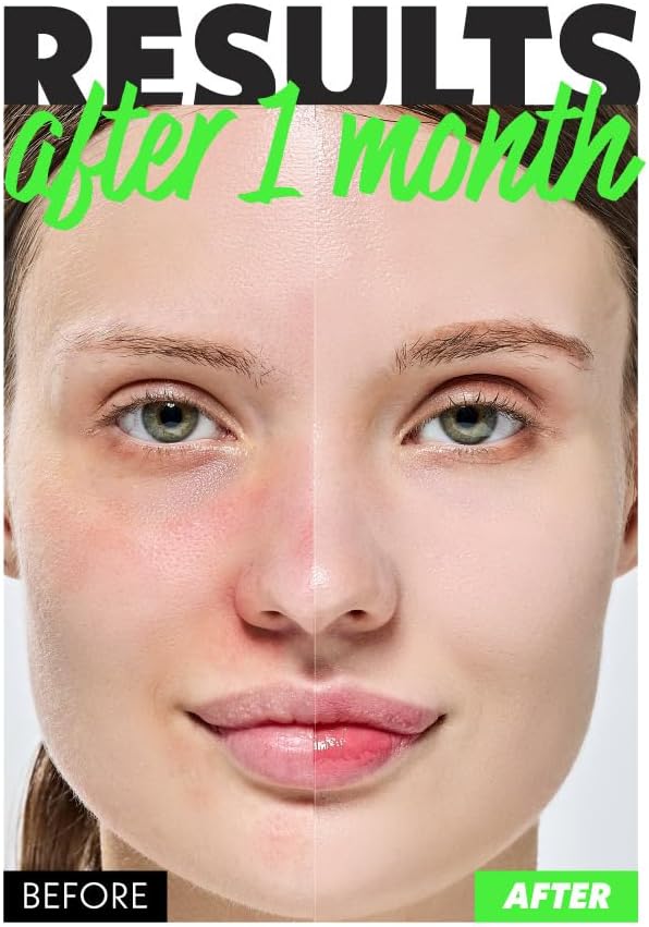 Nosca9 Soothing Toner S | 2% PHA & LHA Exfoliating Toner for Sensitive Skin | Moisturizing, Hypdrating & Quick Absorption Korean Skincare (Pack of 1, 6.76 Fl Oz)