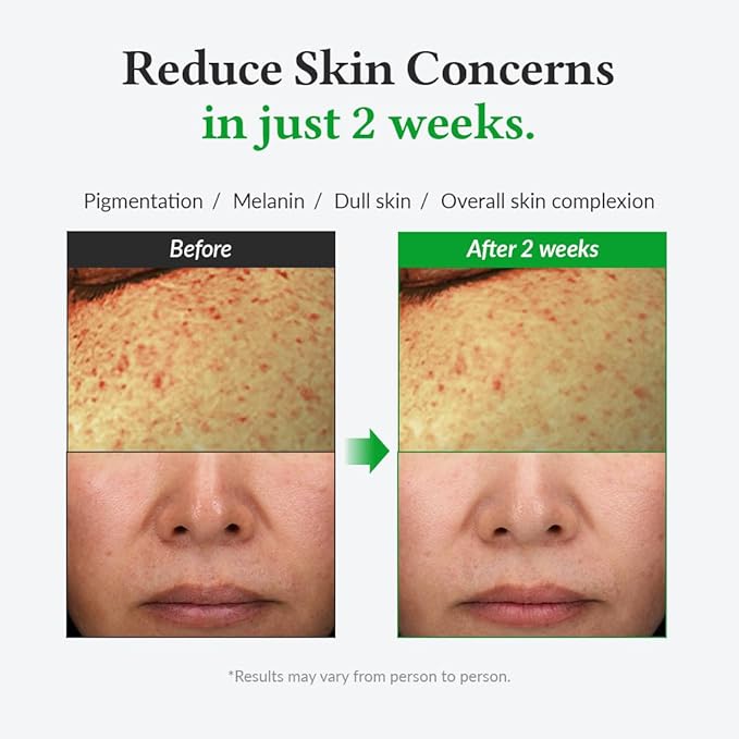 Dr.Althea Gentle Vitamin C Serum | Benefits Skin Tone and Pigmentation | Gentle on Skin For Even Skin Tone | Korean Vegan Skin Care for All Skin Types (Gentle Vitamin C)