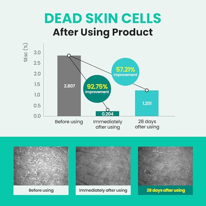 Real Barrier | Porebium Waterlock Essence | Dead Skin Cell Peeling | Face Moisturizer for Sensitive Skin | Pore Cleanser Essence | Hydrating Face Toner | Korean Facial Skincare | 3.71 fl oz (110ml)