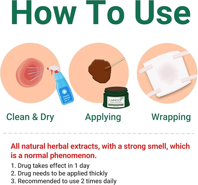 LMNOOP® Perianal Care Cream, Fast Healing Wounds for Anus Fissure, Abscess, Ulcer, Infection, Postpartum & Anal Fistula Surgery Wounds Recovery Ointment, Wound Treatment Cream for Itch Burning Relief