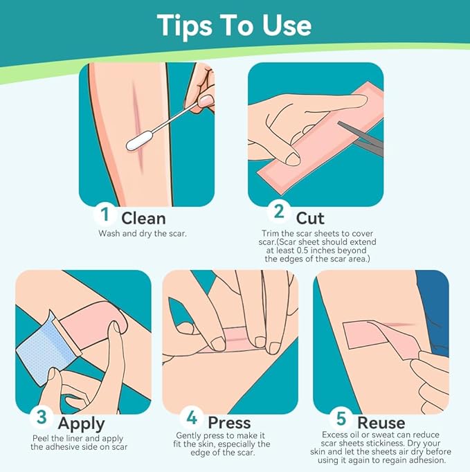 Dimora Medical Grade Silicone Scar Sheets -Ultra Soft Silicone Scar Tape (1.6”x60" Roll), Hypoallergenic Scar Removal Treatment for Surgical Scars, C Section, Tummy Tuck, Keloid Treatment