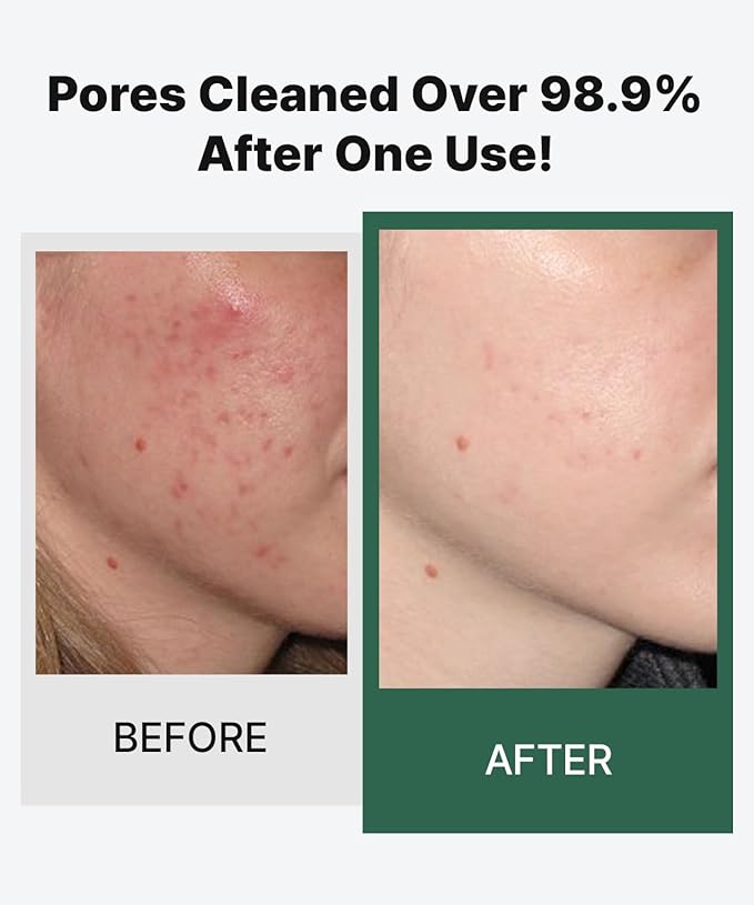 Soy Yogurt Cleanser, Facial Cleanser with Black Soybeans, Greek Yogurt Texture, Face Mask, Scrubber, Deep Pore Face Wash, Blackhead Remover, Korean SkinCare (3.38 fl.oz.)