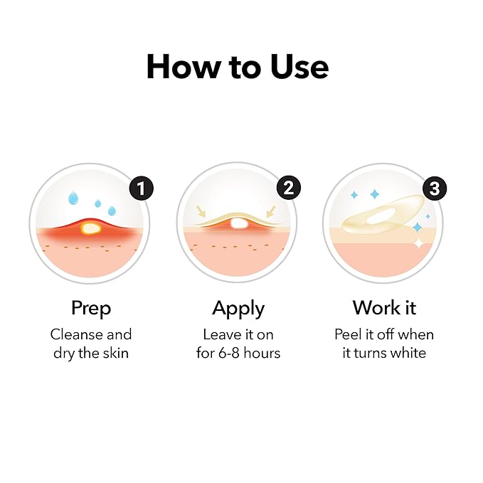 FreeGo Hydrocolloid Acne Patches for Face, Large Pimple Patches for Breakouts, Zit, Blemish Spot, Facial Stickers, Korean Pimple Patches