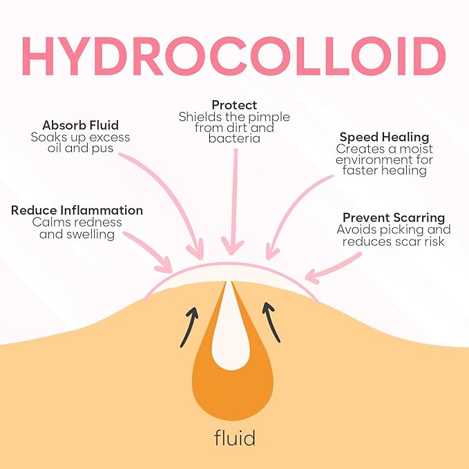 Invisible Pimple Patches for Face (180 Count), Hydrocolloid Stickers Covers Pimples, Zit Patches for Spot Cover, Clear (2 Sizes - S/L)