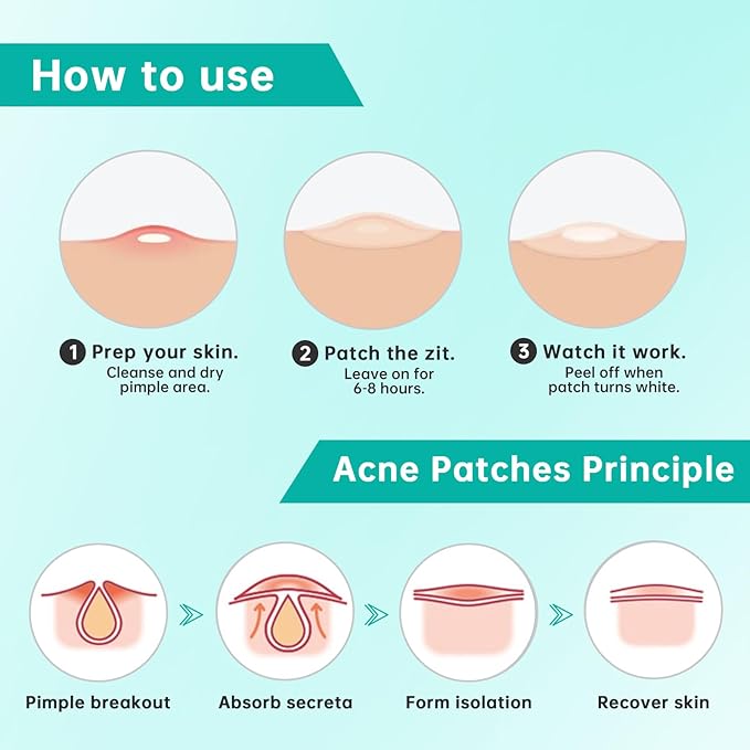Pimple Patches for Face, Acne Patches/Hydrocolloid Patches for Covering Zits and Blemishes/Spot Care for Face,Absorb Fluid,4 size (210 Count)