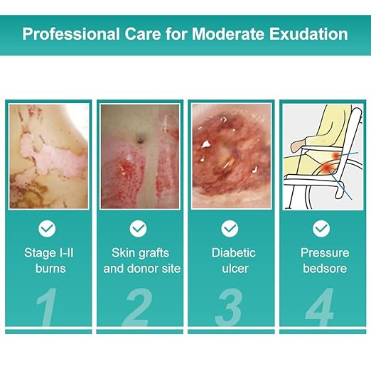 Dimora Hydrocolloid Dressing 4" x 4" for Wound Care, 10 Pack Large Patch Bandages with Self-Adhesive for Bedsore, Burn, Blister, Acne Care, Super Absorbent for Fast Healing