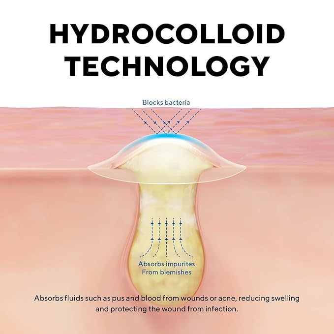 caraseoul Pimple Patches, 2 Size Hydrocolloid Acne Patch for Zits and Blemishes, Bakuchiol & Aloe Vera, Korean Skin Care, Easy to Use – Dermatology Tested