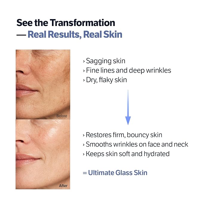 SUNGBOON EDITOR Deep Collagen Retinol Power Boosting Capsule Cream | Microneedling, White Spicules, Skin Firming, Hydration for Dry Skin, Wrinkles, Face Moisturizer, Retinol Cream for Face, 1.69 fl.oz