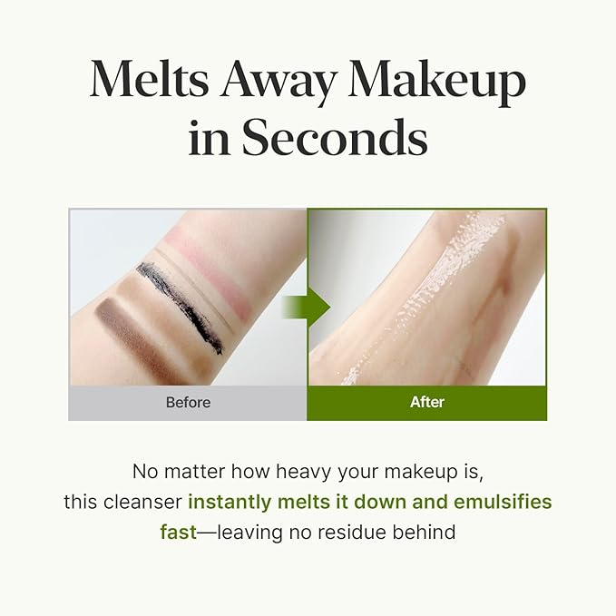 CKD Green Plum AHA·BHA Pore Zero Cleansing Oil - Lightweight Face Oil Cleanser with 4-Acid Complex, Fast Emulsifying, Removes Makeup & Sebum, Hydrating & Low-Irritation. Korean Skincare. 7.03 fl oz