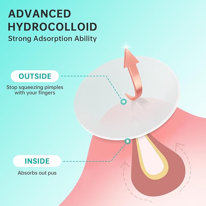 Pimple Patches for Face, Acne Patches/Hydrocolloid Patches for Covering Zits and Blemishes/Spot Care for Face,Absorb Fluid,4 size (210 Count)