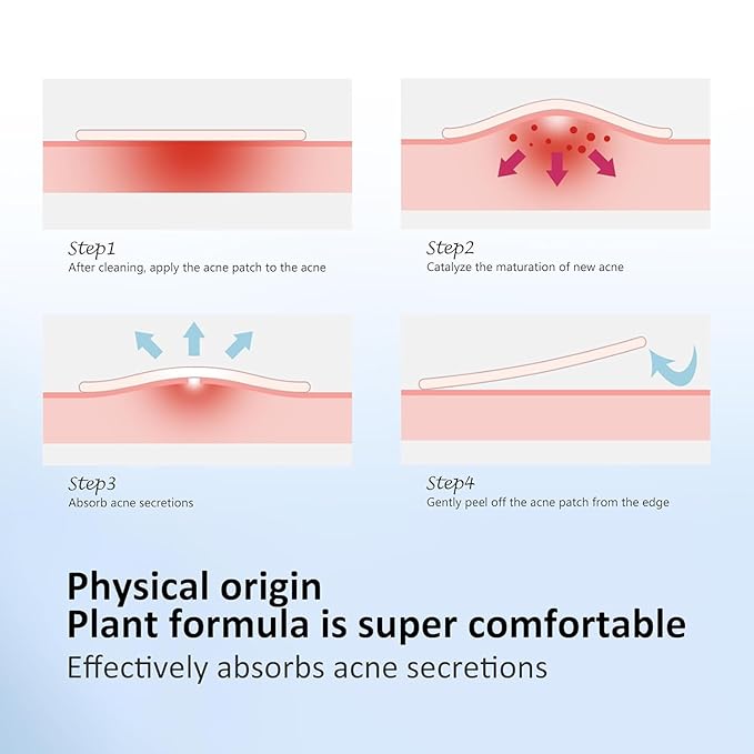 Star Pimple Patches for Face, Acne Patches, Cute Colorful Star Zit Covers with Hydrocolloid & Tea Tree Oil, Salicylic Acid Cica Extract 4 Sizes (8mm/9mm/11mm/14mm) | 255 Count