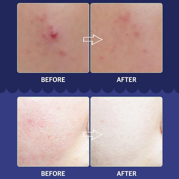 CRAZY SKIN Skin Repair Trouble Care Overnight Sleeping Face Mask 1.76oz | Centella + AHA/BHA Cream | Moisturizer for Acne-Prone Skin | Pore Minimizer Cream Mask with Eggplant Extract, Salicylic acid