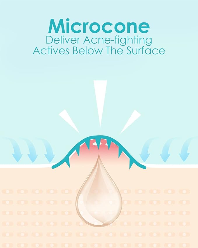 Microdart Acne Patch (18 Patches) - Hyaluronate Acid & Salicylic Acid Hydrocolloid Pimple Patch for Deep, Early and Hidden Blemishes (18 Count (Pack of 1))